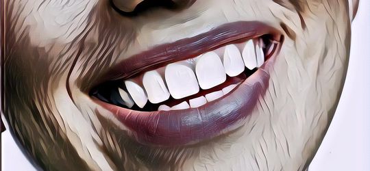 5 Cara Menjaga Kesehatan Gigi Di Rumah, Gigi Sehat Tetap Putih