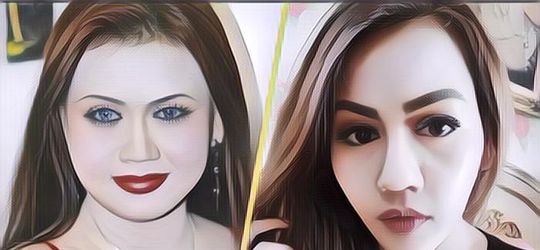Habisin Duit Sampai Miliaran, Ini 5 Artis Indonesia yang Operasi Plastik