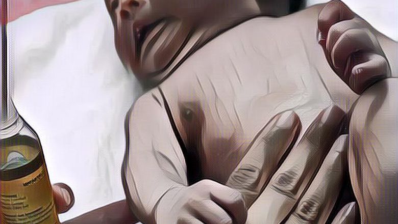 Tips Memilih Minyak Telon yang Pas, Sesuai dengan Kulit Bayi