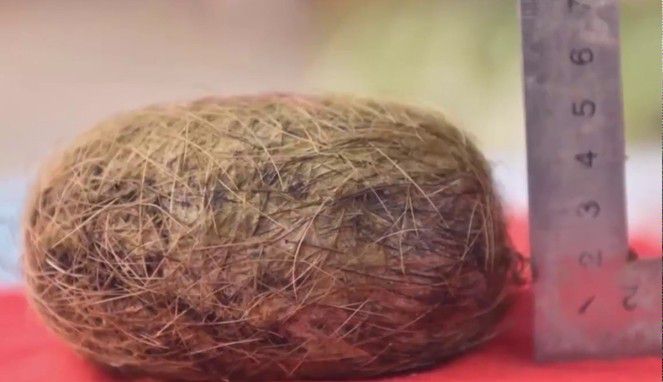 # Manfaat Benzoar untuk Kesehatan Manusia