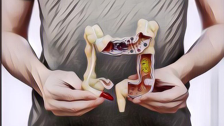 5 Cara Membersihkan Usus Besar Agar Terhindar dari Berbagai Macam penyakit