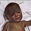 Tanda Bayi Kuning Sembuh dan Ciri-cirinya
