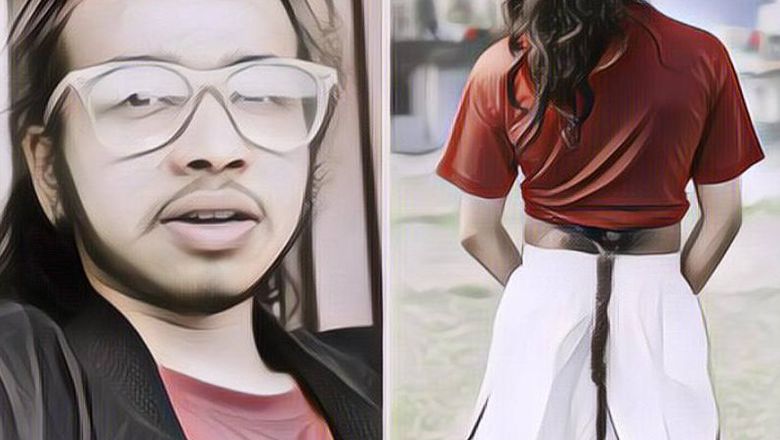 Benar-Benar Nyata! Pria Ini Punya Ekor di Tubuhnya Sepanjang 70 Cm