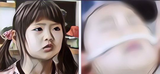 Miris! Anak 9 Tahun Jalani Operasi Plastik Dengan Dukungan Ibu, Ahli Soroti Kemungkinan Ini Bakal Terjadi Saat Dewasa