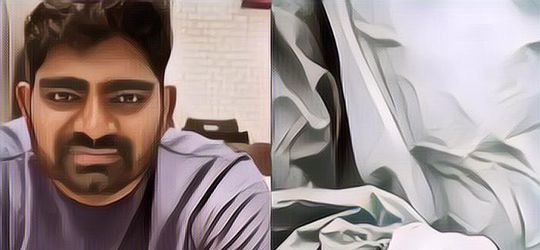 Kronologi Pria Tewas Saat Operasi Perbaikan Senyum Jelang Pernikahan, Ternyata Ini Penyebabnya!