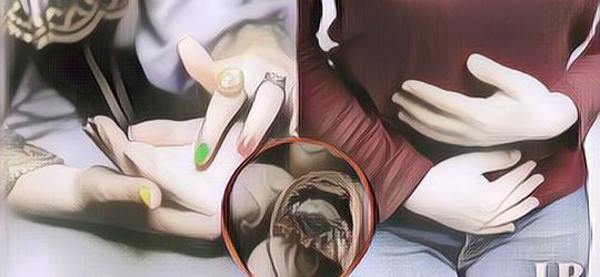 Wanita 27 Tahun Tewas Diduga Gegara Makan Permen Dari Peramal, Sempat Alami Gejala Aneh Ini