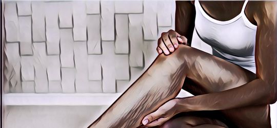 Mengenal Apa Itu Varises dan Cara Mengatasinya Menggunakan Teknologi EVLA