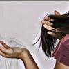 Tips Mencegah Rambut Rontok di Usia Remaja, Hindari Gaya Rambut Ketat Hingga Terapi
