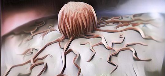 Waspadai Tanda Awal Kanker yang Sedang Berkembang Agar Tidak Terlambat