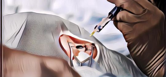 Masalah Penglihatan Apa Saja yang Bisa Diobati dengan Operasi Lasik?