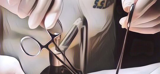 Suami Disunat Setelah Nikah, Istri : Disunat Biar Punya Anak