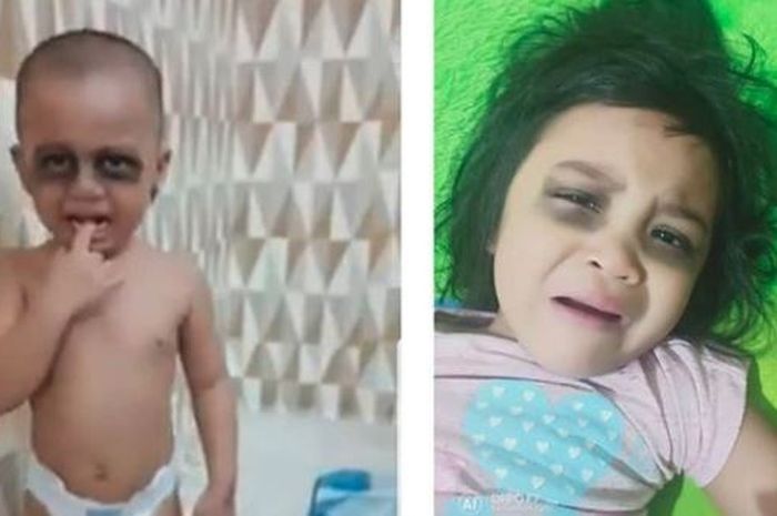 Diberi Lingkaran hitam pada mata