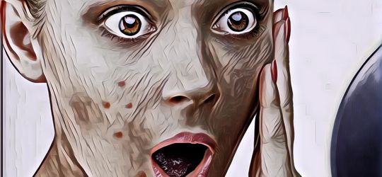 7 Hal Ini Sering Nggak Disadari dan Bisa Jadi Penyebab Munculnya Jerawat Pada Wajah