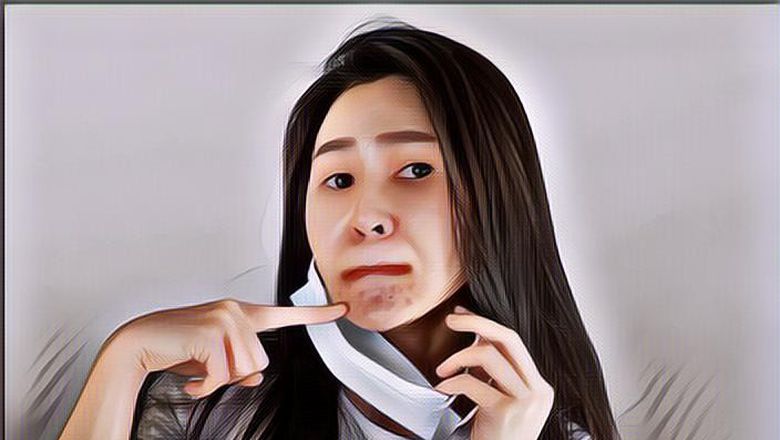 3 Cara Mengatasi Wajah Breakout Tanpa Skincare, Mau Mencoba?