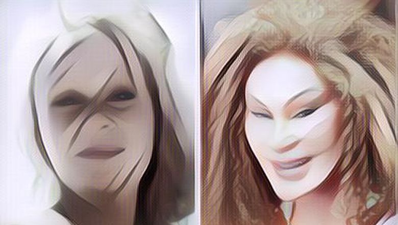 Deretan Wajah Artis yang Makin Aneh Karena Ketagihan Operasi Plastik