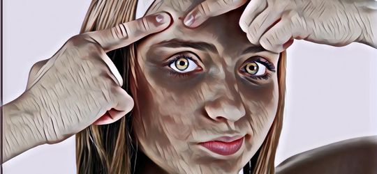 Cara Menghilangkan Jerawat dan Bekas Jerawat yang Oke Banget!