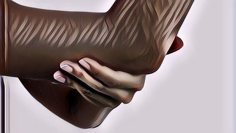 Anti Belang, Ini 5 Cara Sederhana Yang Bisa Mencerahkan Area Sikut Dan Lutut