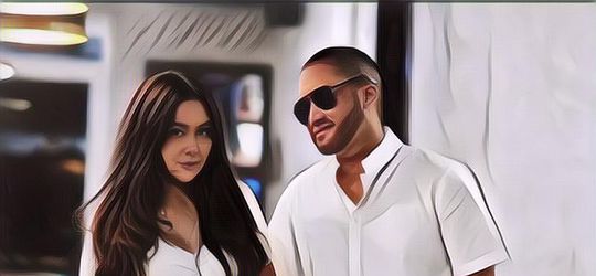 Sedih, Ternyata Ini Alasan Kevin Aprilio Lakukan Transplantasi Rambut Jadi Brewok