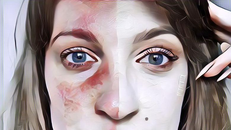 Cewek Wajib Tahu, Ini 5 Tanda Kamu Nggak Cocok Sama Skin Care Yang Lagi Dipakai