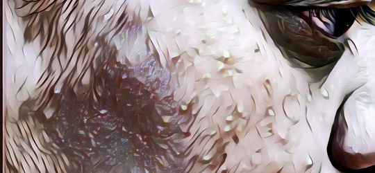 Cara Menghilangkan Milia secara Alami, Gampang Kok Bahannya...