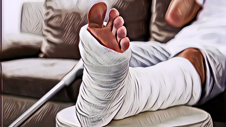 Berapa Lama Patah Tulang Bisa Sembuh?