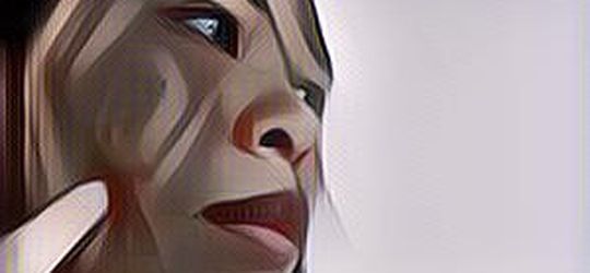 5 Bahan Alami Ini Dipercaya Ampuh Untuk Menghilangkan Bekas Jerawat Menghitam Dan Tak Mau Hilang