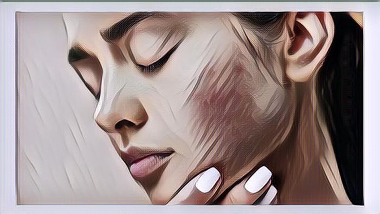 Para Perempuan Wajib Tahu, 5 Cara Mudah Mengatasi Skin Barrier yang Rusak