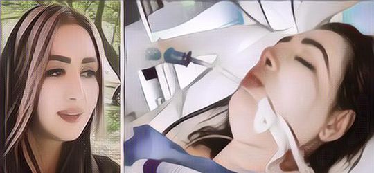 Wanita di Iran Ini Ditembak Sampai Lumpuh Karena Tak Pakai Hijab