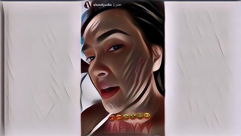 4 Artis yang Tak Malu Unggah Wajahnya Saat Jerawatan, Self Love!