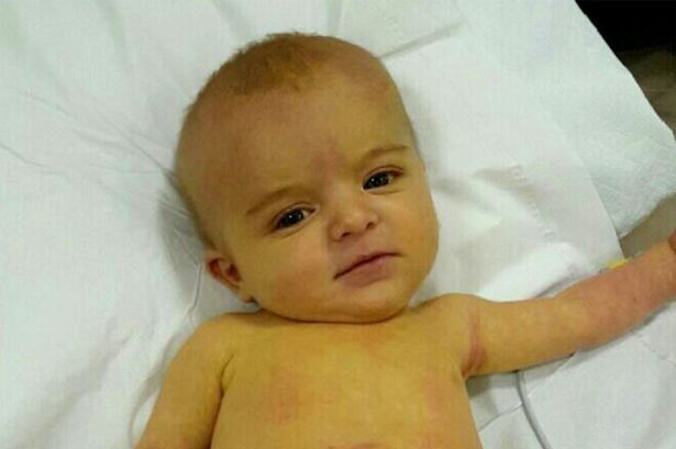 Kapan bayi kuning harus segera diperiksakan ke dokter?