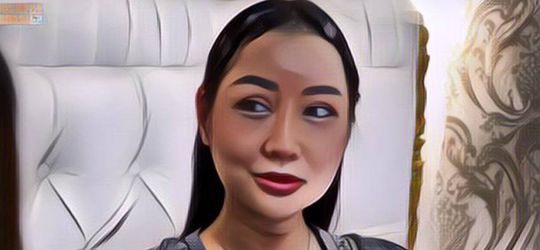 Lucinta Luna Ungkap Alasan Oplas Lagi, Ternyata Hidungnya Jebol