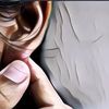 5 Penyebab Jerawat Telinga yang Wajib Dihindari