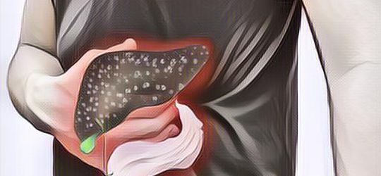 Obat Batu Empedu Herbal yang Sederhana Tapi Ampuh