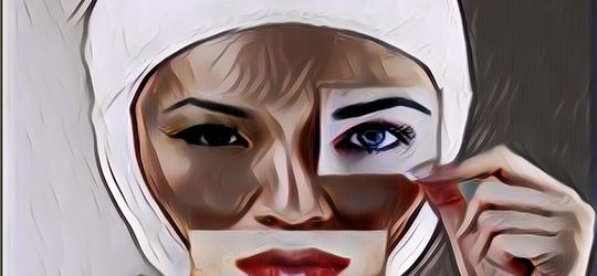 Artis Korea yang Gagal Operasi Plastik Sebelum dan Sesudah