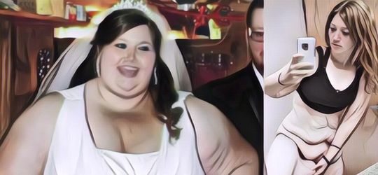 Influencer yang Berhasil Turunkan BB 141 Kg Berakhir Koma, Saat Ini Sulit Berjalan