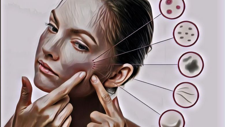 Jangan Diabaikan! Ternyata, Ini 7 Tanda Kulitmu Nggak Cocok Saat Memakai Skincare