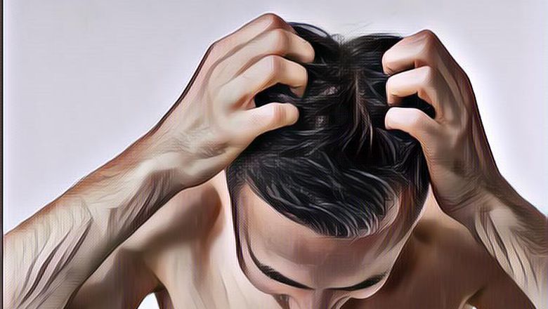 Penyebab dan Gejala Dermatitis Seboroik, Kapan Harus ke Dokter?