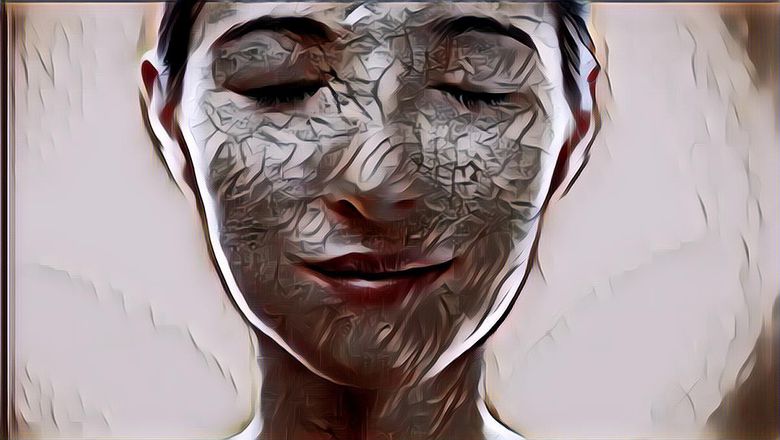 3 Tips Mudah Atasi Kulit Kering di Musim Hujan, Wanita Wajib Tau Nih!