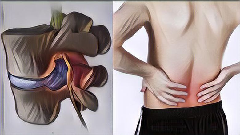 7 Pantangan Saraf Kejepit yang Harus Dihindari Penderita