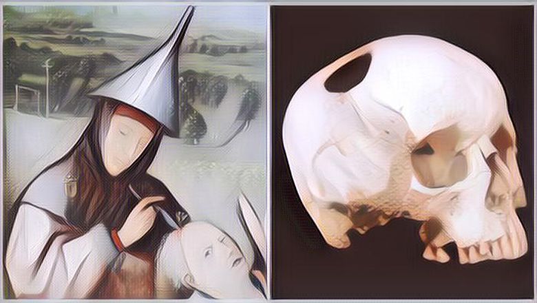 Deretan Teknik Pengobatan Menyeramkan yang Masih Dipakai Hingga Saat Ini