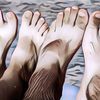 Cara Mengatasi Kulit Belang Akibat Paparan Sinar Matahari