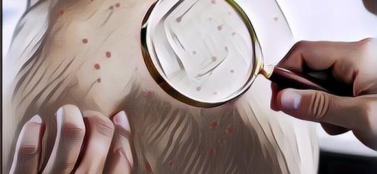 5 Cara Ini Ampuh Membersihkan Jerawat Punggung dengan Cepat!