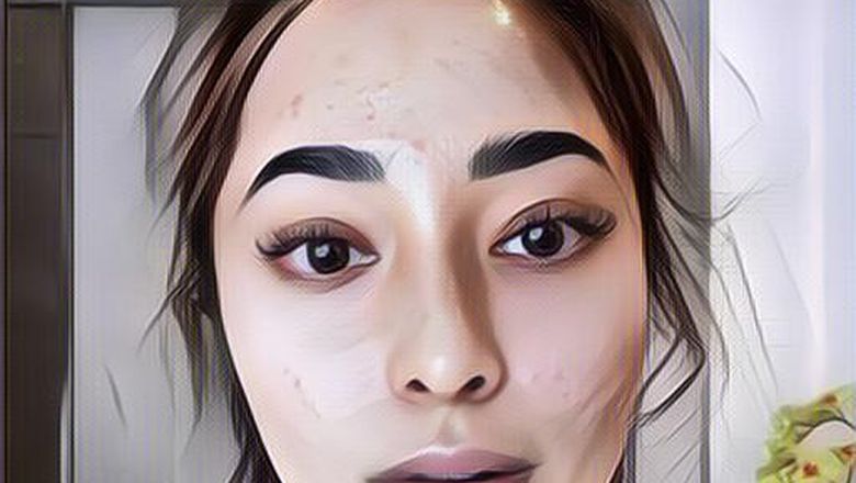 Heboh Nikita Willy Jerawatan Pertama Kali, Minder Ketemu Orang Hingga Menangis Setiap Malam