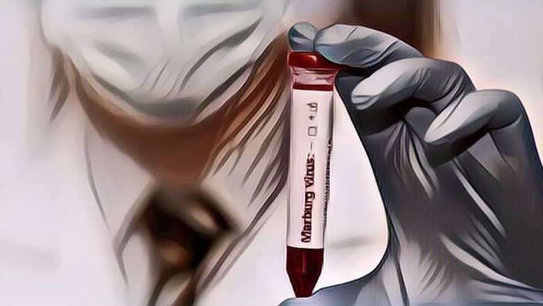 Mengenal Virus Marburg yang Disebut-Sebut Bocor dari Lab di Jerman