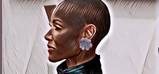 Mengenal Alopecia, Kerontokan Rambut yang Dialami Jada Pinket Smith dan Dijadikan Punch Line oleh Chris Rock