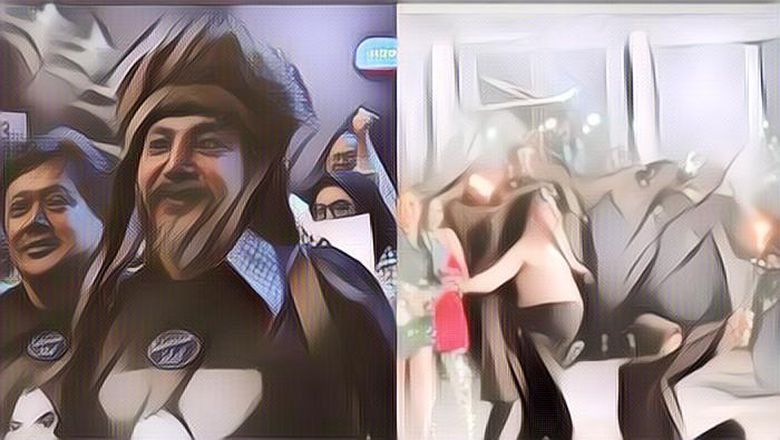 Limbad Dilarikan ke Rumah Sakit Usai Jenggotnya Terbakar Api Saat Tampil