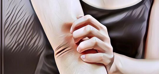 Yuk Mengenal Dermatitis Seboroik: Gangguan Kulit dengan Gejala Kulit Bersisik, Kemerahan, dan Ketombe!