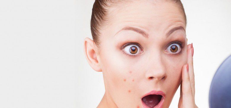 Menyembuhkan jerawat