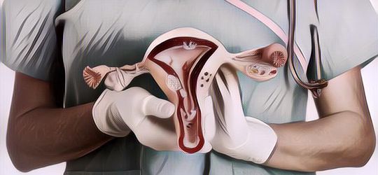 Kenali Gejala Kista Ovarium, Penyakit yang Sempat Diderita Aurel Hermansyah