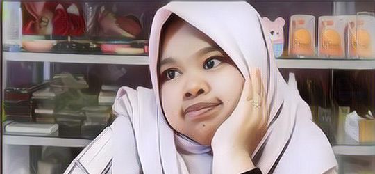 Rangkaian Treatment Kecantikan Kekeyi, dari Filler Hidung hingga Diet Ketat